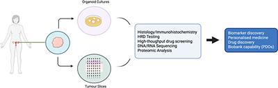 Novel <mark class="highlighted">Ex Vivo Models</mark> of Epithelial Ovarian Cancer: The Future of Biomarker and Therapeutic Research